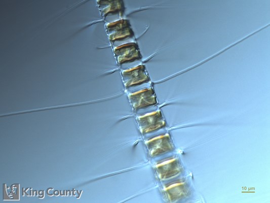 Photo of Chaetoceros diadema